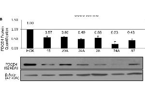 PDCD4 mRNA and PDCD4 protein levels in OSCC cell lines.