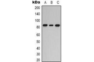 Western blot analysis of PKC epsilon expression in HEK293T (A), Hela (B), HepG2 (C) whole cell lysates. (PKC epsilon anticorps  (C-Term))
