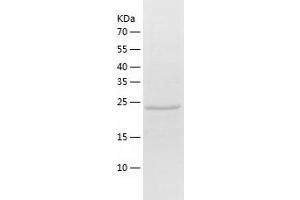 Western Blotting (WB) image for Ubiquitin-Conjugating Enzyme E2E 3 (UBE2E3) (AA 1-207) protein (His tag) (ABIN7125615) (UBE2E3 Protein (AA 1-207) (His tag))