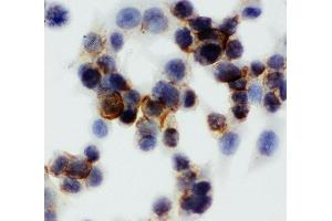Anti-Annexin V antibody, ICC ICC: HCT116 Cell (Annexin V anticorps  (Middle Region))