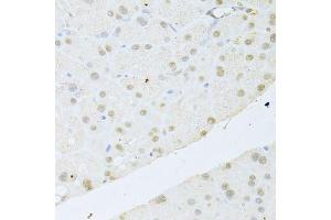 Immunohistochemistry of paraffin-embedded mouse pancreas using AKT1 antibody. (AKT1 anticorps  (C-Term))