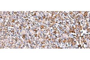 Immunohistochemistry of paraffin-embedded Human tonsil tissue using IP6K1 Polyclonal Antibody at dilution of 1:40(x200)