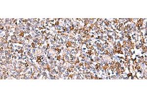 Immunohistochemistry of paraffin-embedded Human tonsil tissue using IP6K1 Polyclonal Antibody at dilution of 1:40(x200) (IP6K1 anticorps)