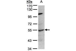 WB Image Sample(30 ug whole cell lysate) A:Raji , 7. (PTPN1 anticorps)
