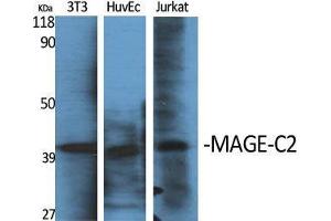 Western Blot (WB) analysis of specific cells using MAGE-C2 Polyclonal Antibody. (MAGEC2 anticorps  (Internal Region))