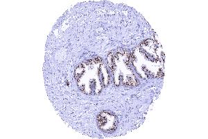 Normal prostate with strong granular perinuclear cytoplasmic prostein staining of luminal cells (Recombinant SLC45A3 anticorps  (N-Term))