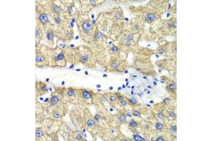 Immunohistochemistry of paraffin-embedded human liver injury using ABAT antibody (ABIN1876487) at dilution of 1:100 (40x lens). (ABAT anticorps)