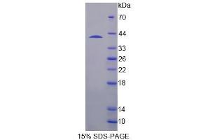 SDS-PAGE analysis of Human SH3BP2 Protein. (SH3BP2 Protéine)