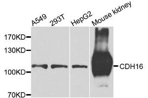 Western blot analysis of extracts of various cell lines, using CDH16 antibody. (Cadherin-16 anticorps  (AA 19-230))