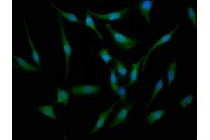 Immunofluorescence staining of Hela cells with ABIN7145246 at 1:133, counter-stained with DAPI. (BBS7 anticorps  (AA 289-393))