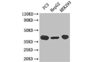 Western Blot Positive WB detected in: PC-3 whole cell lysate, HepG2 whole cell lysate, HEK293 whole cell lysate All lanes: C5AR1 antibody at 3 μg/mL Secondary Goat polyclonal to rabbit IgG at 1/50000 dilution Predicted band size: 40 kDa Observed band size: 40 kDa (C5AR1 anticorps  (AA 1-36))