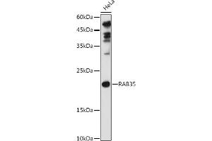 Western blot analysis of extracts of HeLa cells, using R antibody (ABIN6133143, ABIN6146576, ABIN6146578 and ABIN6224057) at 1:1000 dilution. (RAB35 anticorps  (AA 1-201))