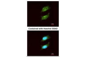 ICC/IF Image Immunofluorescence analysis of methanol-fixed HeLa, using PKA alpha, antibody at 1:200 dilution.