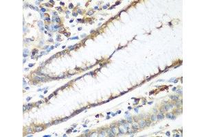 Immunohistochemistry of paraffin-embedded Human stomach using CAD Polyclonal Antibody at dilution of 1:100 (40x lens).