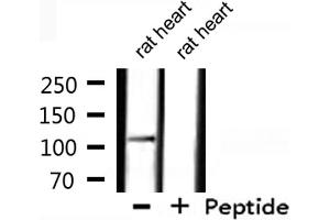 Western blot analysis of extracts from rat heart, using XPF Antibody. (ERCC4 anticorps  (C-Term))