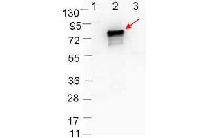 Western blot showing detection of 0. (OspB anticorps)