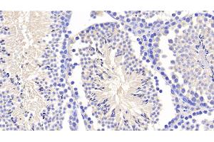 Detection of APP in Mouse Testis Tissue using Polyclonal Antibody to Amyloid Precursor Protein (APP) (APP anticorps  (AA 18-286))
