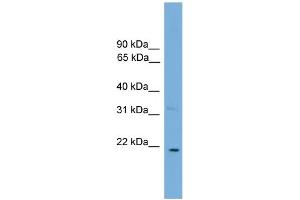 WB Suggested Anti-CTF1  Antibody Titration: 0.