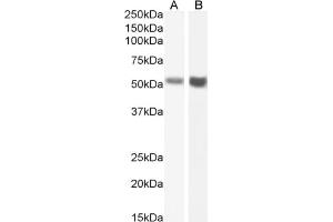 Western Blot using anti-Fas antibody R-125224. (Recombinant FAS anticorps)