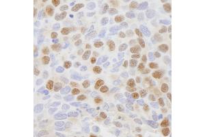 anti-CSE1 Chromosome Segregation 1-Like (CSE1L) (AA 1-50) antibody