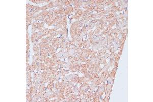 Immunohistochemistry of paraffin-embedded rat heart using MZB1 antibody (ABIN7268403) at dilution of 1:100 (40x lens).