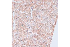Immunohistochemistry of paraffin-embedded rat heart using MZB1 antibody (ABIN7268403) at dilution of 1:100 (40x lens). (MZB1 anticorps  (AA 1-189))