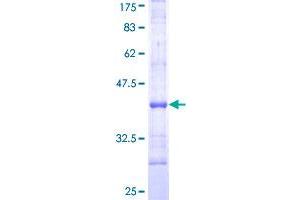 Image no. 1 for Interleukin 1 Receptor, Type II (IL1R2) (AA 21-120) protein (GST tag) (ABIN1307757)