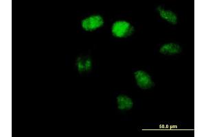 Immunofluorescence of purified MaxPab antibody to ZBTB3 on HeLa cell. (ZBTB3 anticorps  (AA 1-574))