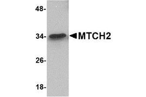 Western Blotting (WB) image for anti-Mitochondrial Carrier 2 (MTCH2) (N-Term) antibody (ABIN1031463) (MTCH2 anticorps  (N-Term))