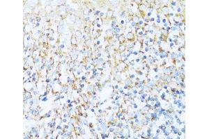 Immunohistochemistry of paraffin-embedded Human tonsil using NDUFA5 Polyclonal Antibody at dilution of 1:100 (40x lens). (NDUFA5 anticorps)