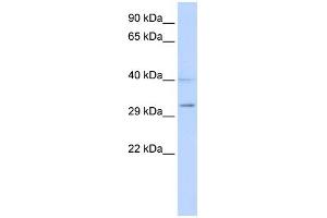 WB Suggested Anti-SIRT5 Antibody Titration:  0. (SIRT5 anticorps  (Middle Region))