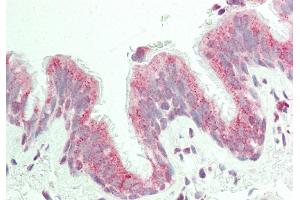 Rabbit Anti-KIAA0317 antibody  Formalin Fixed Paraffin Embedded Tissue: Human Lung, Respiratory Epithelium Primary antibody Concentration: 1:100 Secondary Antibody: Donkey anti-Rabbit-Cy3 Secondary Antibody Concentration: 1:200 Magnification: 20x Exposure Time: 0. (AREL1 anticorps  (N-Term))