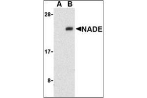 Western blot analysis of NADE in Human brain cell lysates with this product at 1 μg/ml in the presence (A) or absence (B) of blocking peptide.