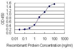 Detection limit for recombinant GST tagged SYCE1 is 0.