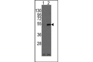 Image no. 1 for anti-Dystrobrevin Binding Protein 1 (DTNBP1) (C-Term) antibody (ABIN357846) (DTNBP1 anticorps  (C-Term))