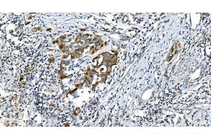 IHC analysis of DRP1/DNM1L using anti-DRP1/DNM1L antibody (ABIN7602180). (Dynamin 1-Like anticorps  (AA 618-736))