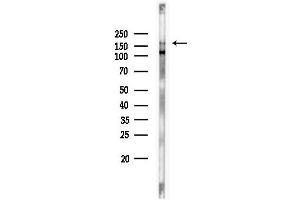 Western blot analysis of lysates from EC304 cells, using Phospho-EGFR (Tyr1068)[Tyr1092] Antibody at 1/1000 dilution.