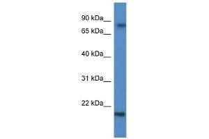 Western Blot showing KRTAP1-5 antibody used at a concentration of 1 ug/ml against Fetal Brain Lysate (KRTAP1-5 anticorps  (C-Term))