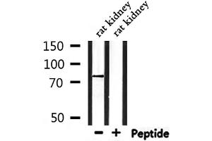 Western blot analysis of extracts from rat kidney, using CPT2 Antibody.