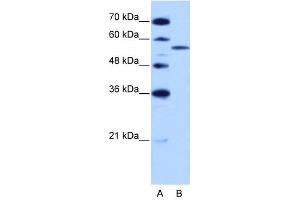 ZRSR2 antibody used at 2. (ZRSR2 anticorps)