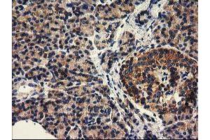 Image no. 5 for anti-Histone Deacetylase 6 (HDAC6) antibody (ABIN1498618)