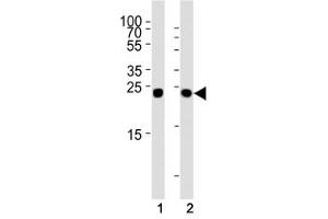 Western blot analysis of lysate from (1) HT29 and (2) HepG2 cell line using Glucagon antibody at 1:1000.