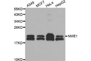 Western blot analysis of extracts of various cell lines, using NME1 antibody (ABIN5970089) at 1/1000 dilution. (NME1 anticorps  (C-Term))