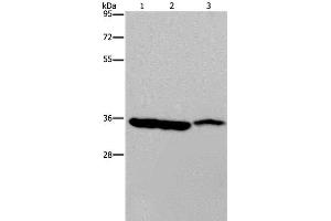 Western Blot analysis of Mouse heart, liver and stomach tissue using MDH1 Polyclonal Antibody at dilution of 1:500 (MDH1 anticorps)