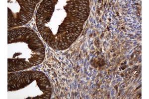 Image no. 2 for anti-TAP Binding Protein-Like (TAPBPL) antibody (ABIN1501302)