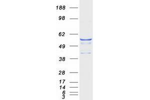 Validation with Western Blot (ATP6V1B1 Protein (Myc-DYKDDDDK Tag))