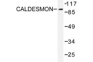 Image no. 1 for anti-Caldesmon 1 (CALD1) antibody (ABIN271923) (Caldesmon anticorps)