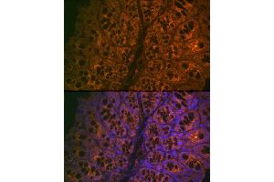 Immunofluorescence analysis of mouse large intestine cells using CE Rabbit mAb (ABIN7266085) at dilution of 1:100 (40x lens). (CEACAM6 anticorps)