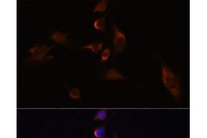 Immunofluorescence analysis of C6 cells using ELAVL3 Polyclonal Antibody at dilution of 1:100 (40x lens).