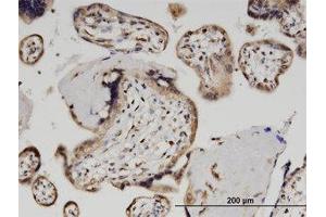 Image no. 1 for anti-Zinc Finger and SCAN Domain Containing 29 (ZSCAN29) (AA 101-200) antibody (ABIN599613) (ZSCAN29 anticorps  (AA 101-200))